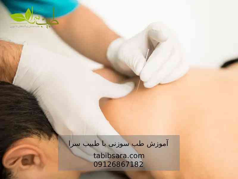 دوره طب سوزنی