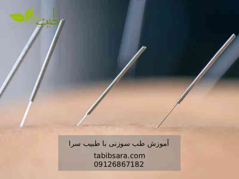 دوره حضوری طب سوزنی