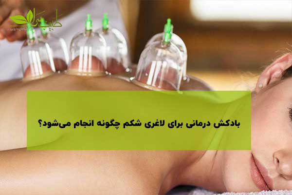 بادکش درمانی برای لاغری شکم بادکش درمانی برای لاغری شکم